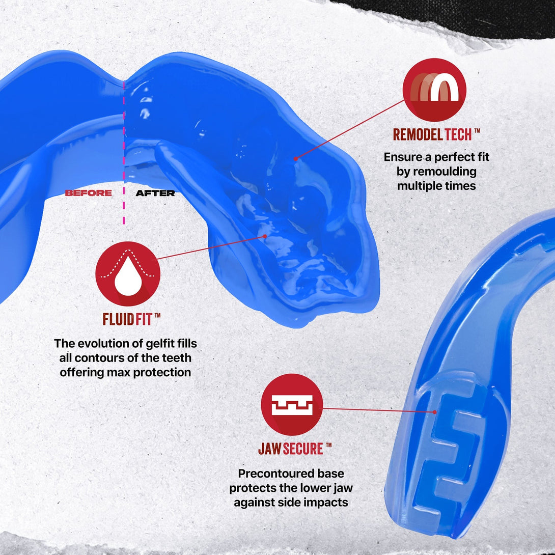 Safejawz Extro Series ICE Kids Mouthguard Blue